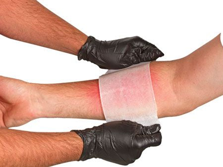 BurnTec Hydrogel Burn Dressing – 4” x 4” Emergency Burn Pad | Sterile Cooling First Aid Dressing